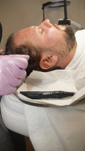 Gesichtsbehandlung - Microneedling